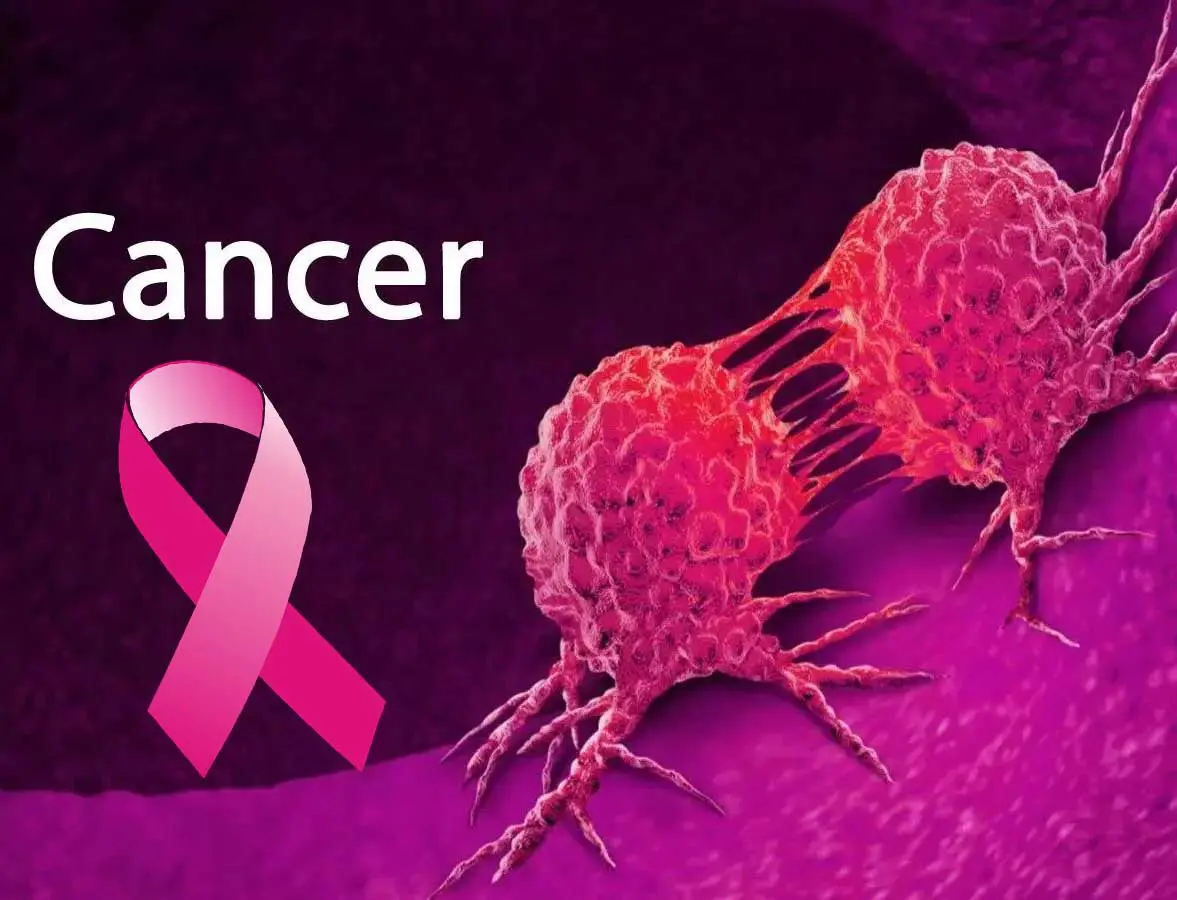 Fast Food and Soda Fuel Mouth Cancer Surge