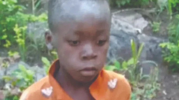Boy Survives Lions Encounter After 5 Days