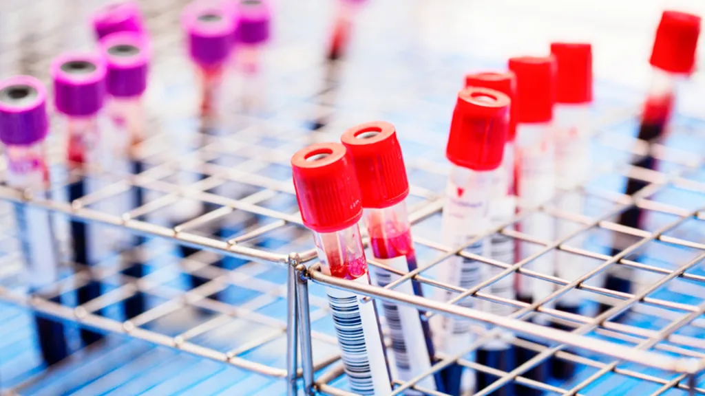 Uganda Nears HIV Victory, Hits 94-90-96 Targets for 2024