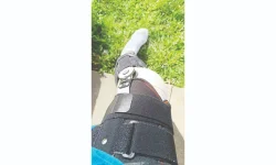 Chipfumo Denies Bailing, Battles Painful Knee Injury.webp