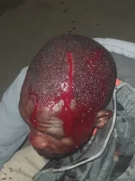 Bulawayo Machete Gang Terrorizes Night Walkers.webp