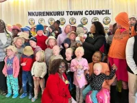 Namibia Census Shocker 38000 Living With Albinism.webp