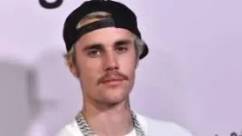 Justin Bieber Admits HE IS Mentally Burnt Out.webp