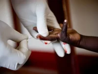Uganda Hits 1.5 Million HIV Cases, Gender Gaps Widen Crisis.webp
