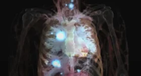 WEHI lab in Melbourne warns MCL1 cancer drugs could torch your heart.webp