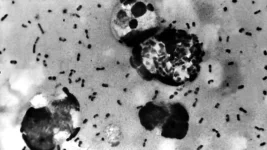 Black Death returns to America, claims first victim in Arizona.webp
