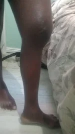 Nicholas Zakaria says he is dying slowly as illness worsens.webp