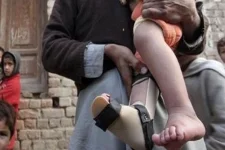 Pakistan's 2025 polio cases climb to eighteen with new Tank victim.webp