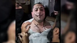 Omar Khairi's attack in al-Bab sparks outrage over artist safety in northern Syria.webp