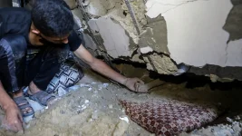 Gaza injuries worst ever seen, say foreign doctors in a new BMJ study.webp