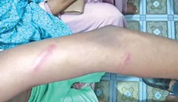 Joypurhat teachers vanish as parents storm school.webp