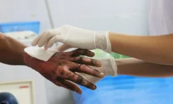 Benjamin Mkapa Hospital partners with Interburns to improve burn care.webp