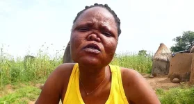 Bongo women Matilda and Aniah battle leprosy.webp