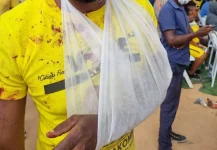 ZPP reports 2,531 hit by October political violence.webp