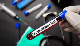 Leptospirosis grips Jamaica after Hurricane Melissa floods.webp
