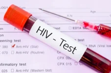 HIV crisis among youth worsens after COVID disruption.webp