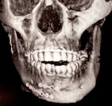 Chymamusique shares skull X-ray, four months after near-fatal crash.webp