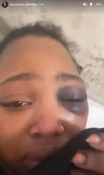 S.A. stylist says cop inaction let boyfriend beat her for months.webp