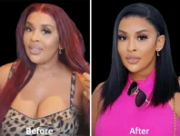 Nonku Williams shares face surgery details from Klutch Plastic Surgery.webp
