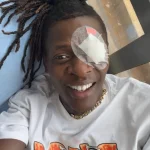 Chameleone undergoes eye surgery to save his right sight.webp