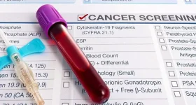 MUHAS partners with Oxford to strengthen cancer care research.webp