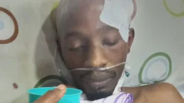 Kassim Ssemujju's family sought aid after a machete attack.webp